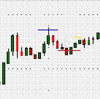 surestoploss.JPG