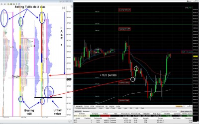 Profile y zonas DAX