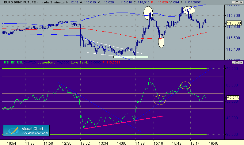 Sincronizacion  bund 11-1.gif